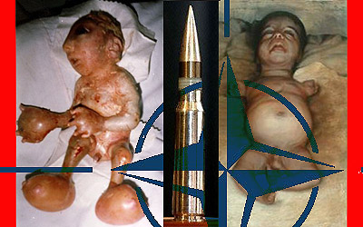Niños víctima de mutaciones por uranio empobrecido
